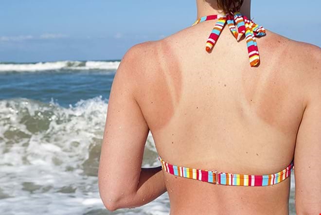 Liệu trình chăm sóc da body trắng mượt cho ngày hè tự tin