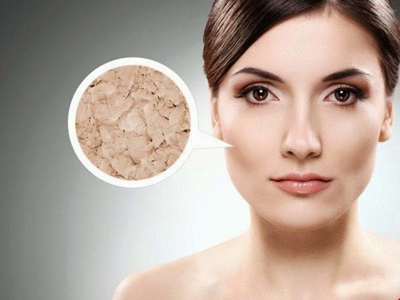 9 cách cung cấp độ ẩm cho da mặt dầu mụn khô từ phương pháp tự nhiên